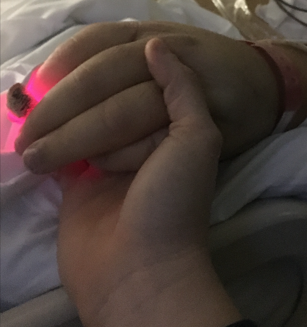 Holding hands in the MICU while he was sedated and on the ventilator.